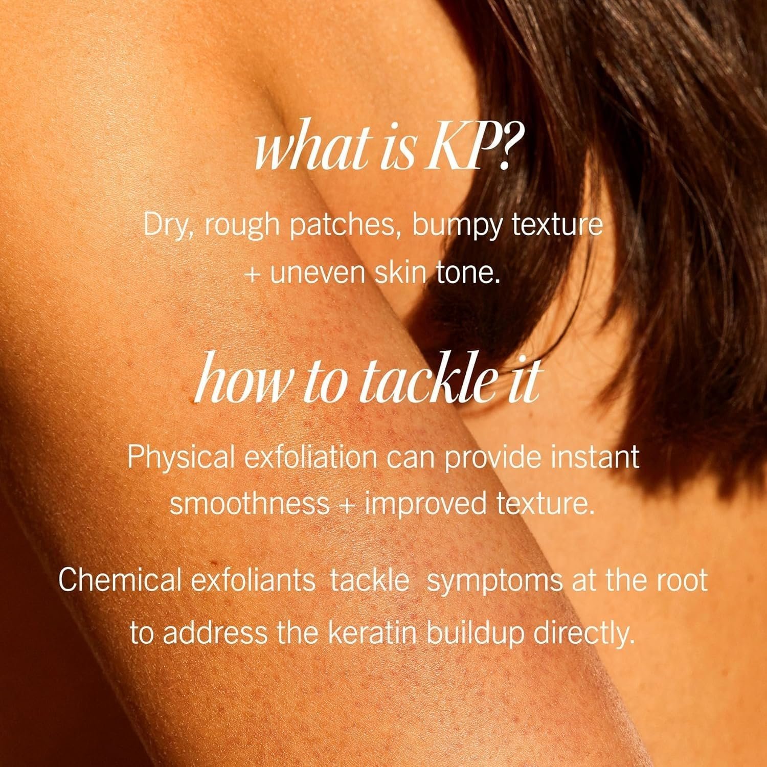 First Aid Beauty - KP Bump Eraser Body Scrub with 10% AHA, Keratosis Pilaris Skin Exfoliater with Glycolic and Lactic acids, Helps Reduce Chicken Skin Bumps, Safe for Sensitive Skin, 10 oz - Image 3