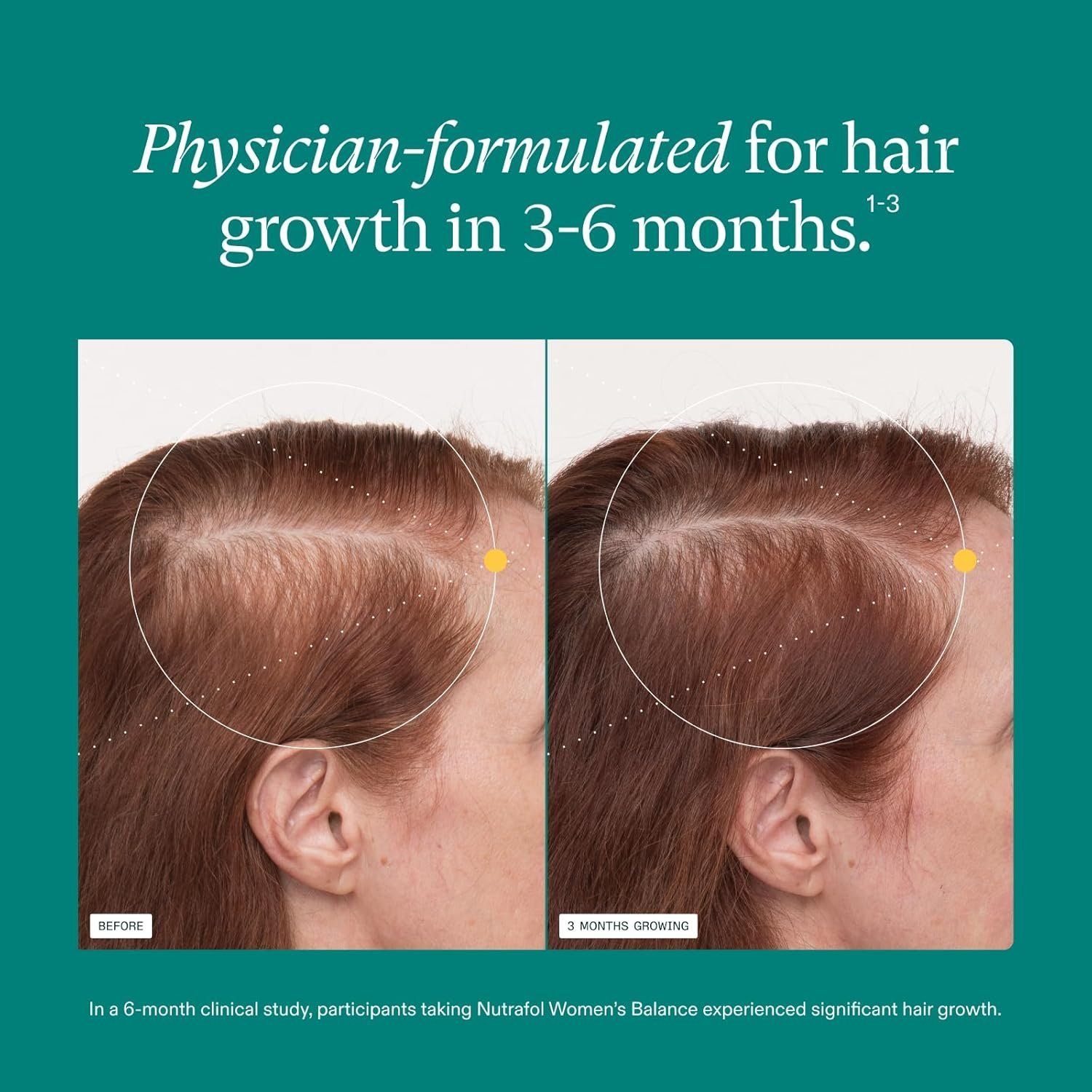 Nutrafol Women's Balance Hair Growth Supplements, Ages 45 and Up, Clinically Proven for Visibly Thicker Hair and Scalp Coverage, Dermatologist Recommended - 1 Month Supply - Image 4